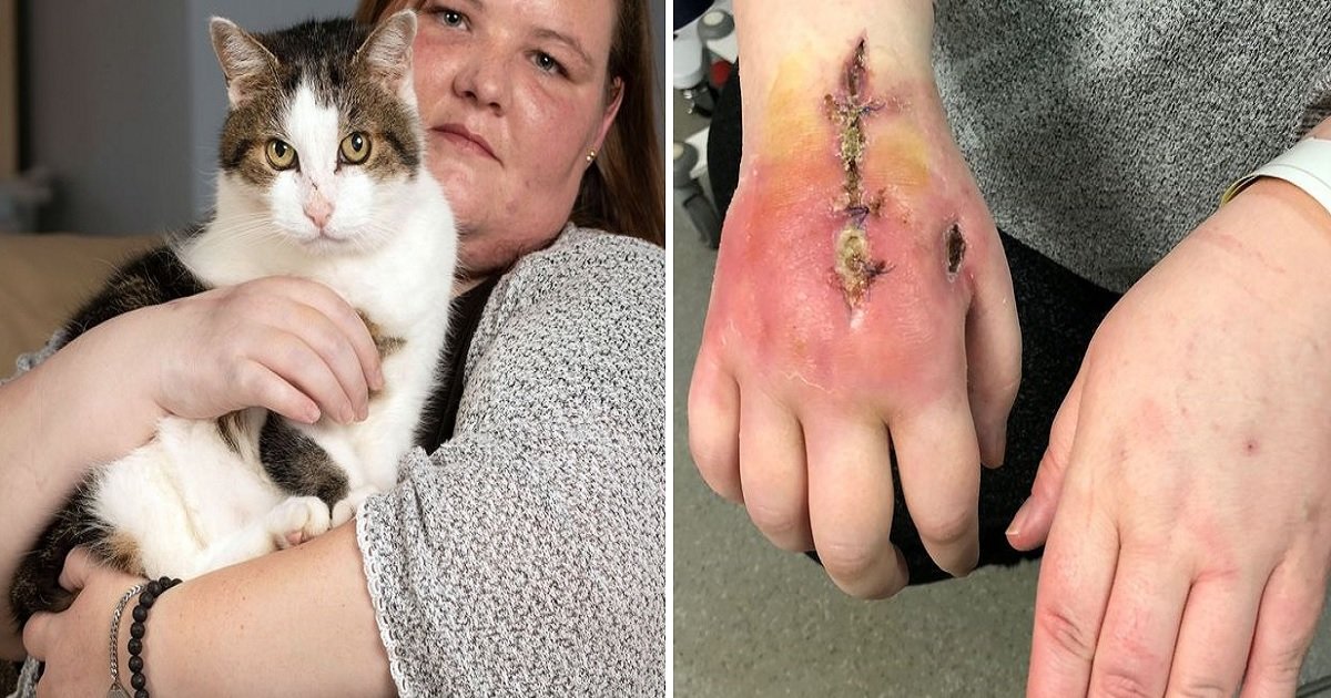 She Nearly Lost Her Hand Due to A Nip by Her Cat, But She’s Not Planning to Get Rid of Smidge!